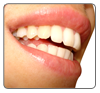Estética Dental